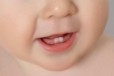 Dental Care For Baby Teeth and Gums